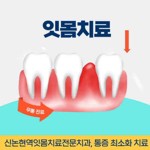 하남치과 하남시 치과 잇몸치료